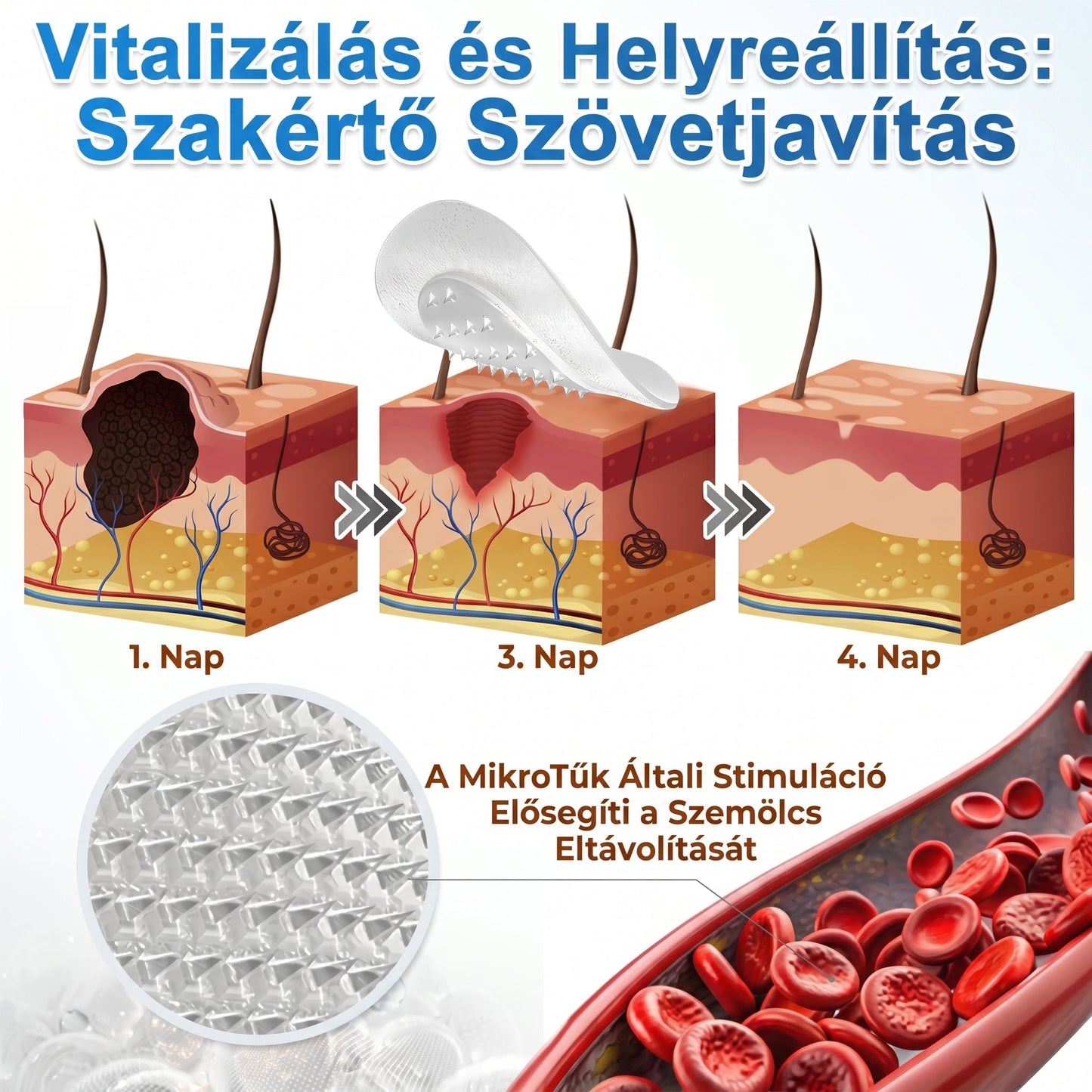 🎁 Már csak 5 doboz maradt. További 30%-os kedvezményt kínálunk Önnek! Ha most elszalasztja ezt a lehetőséget, jövőre már nem lesz rá esélye.
