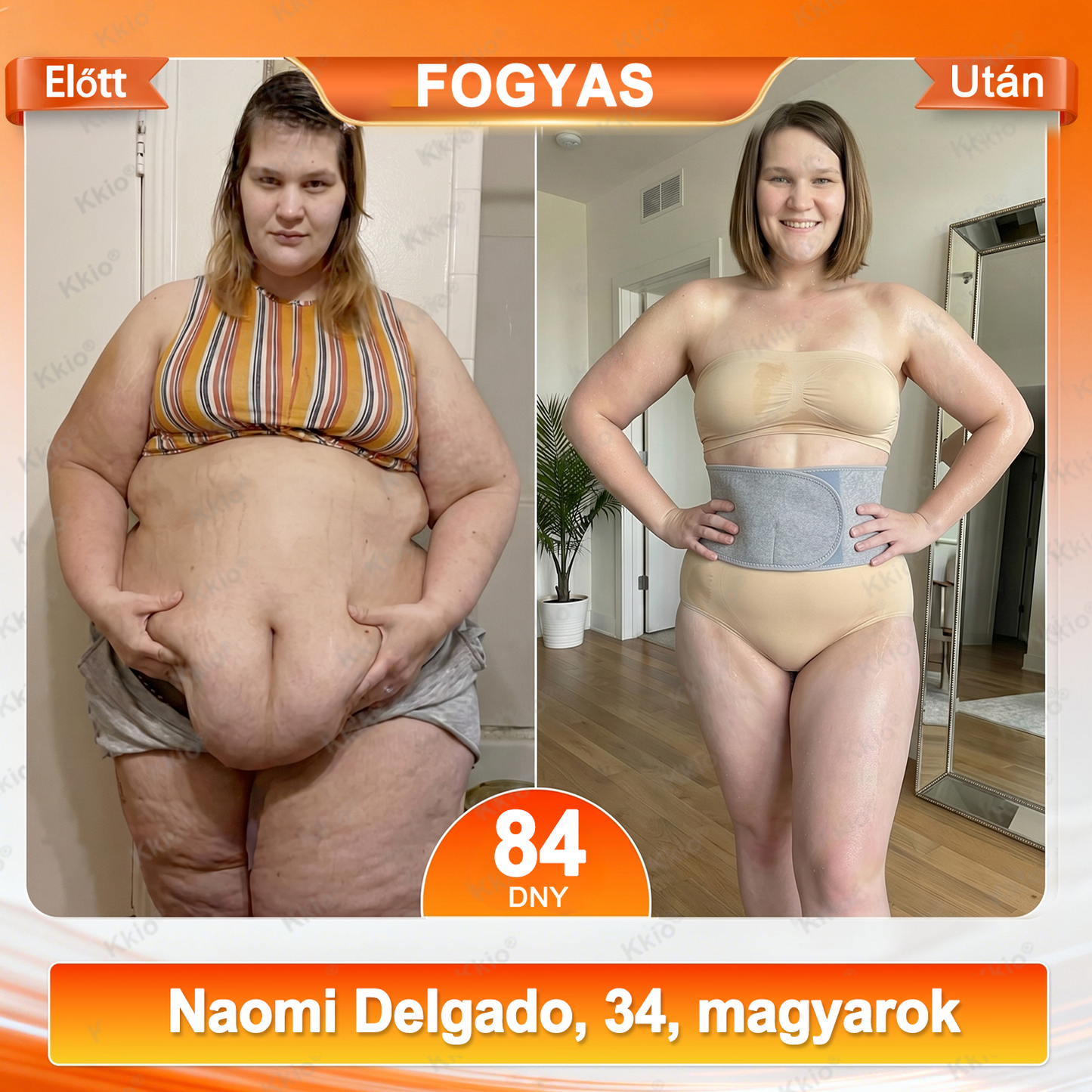🍒🍒🍒 𝐅𝐞𝐝𝐞𝐳𝐝 𝐟𝐞𝐥 𝐚 𝐭𝐢𝐭𝐤𝐨𝐭 – 𝐚𝐳 ú𝐣 𝐊𝐤𝐢𝐨®👩 𝟒 𝐚𝐳 𝟏-𝐛𝐞𝐧 𝐚𝐥𝐚𝐤𝐟𝐨𝐫𝐦á𝐥ó & 𝐳𝐬í𝐫é𝐠𝐞𝐭ő 𝐨𝐯 mikrorészecskés moringával & berberinnel ☘️ 𝐂𝐬𝐚𝐤 𝐚 𝐦á𝐫𝐤𝐚 𝐡𝐢𝐯𝐚𝐭𝐚𝐥𝐨𝐬 𝐰𝐞𝐛á𝐫𝐮𝐡á𝐳á𝐛𝐚𝐧 | ✅ 𝐄𝐫𝐞𝐝𝐞𝐭𝐢 𝐭𝐞𝐫𝐦é𝐤