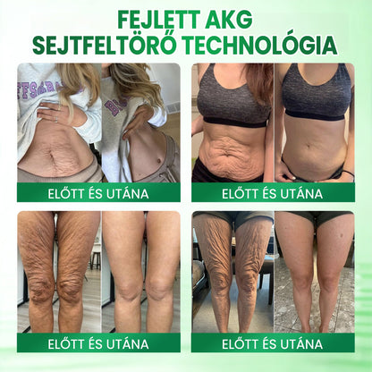 Medistart® AKG BŐRFESZESÍTŐ & ÖREGEDÉS ELLENI ÁPOLÁS