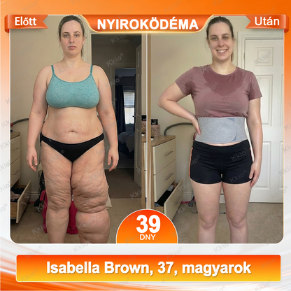 🍒🍒🍒 𝐅𝐞𝐝𝐞𝐳𝐝 𝐟𝐞𝐥 𝐚 𝐭𝐢𝐭𝐤𝐨𝐭 – 𝐚𝐳 ú𝐣 𝐊𝐤𝐢𝐨®👩 𝟒 𝐚𝐳 𝟏-𝐛𝐞𝐧 𝐚𝐥𝐚𝐤𝐟𝐨𝐫𝐦á𝐥ó & 𝐳𝐬í𝐫é𝐠𝐞𝐭ő 𝐨𝐯 mikrorészecskés moringával & berberinnel ☘️ 𝐂𝐬𝐚𝐤 𝐚 𝐦á𝐫𝐤𝐚 𝐡𝐢𝐯𝐚𝐭𝐚𝐥𝐨𝐬 𝐰𝐞𝐛á𝐫𝐮𝐡á𝐳á𝐛𝐚𝐧 | ✅ 𝐄𝐫𝐞𝐝𝐞𝐭𝐢 𝐭𝐞𝐫𝐦é𝐤