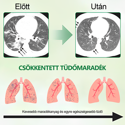 🍀𝐆𝐨𝐨𝐲𝐞𝐞𝐫™ Fejlett Tüdőtisztító Spray -Támogatja a tüdő, a hörgők és az orrmelléküregek egészségét, elősegíti a légzőrendszer egészségét és a könnyebb légzést